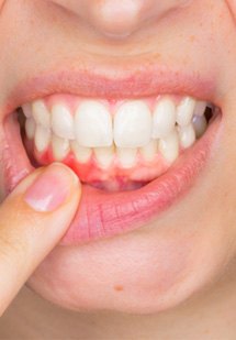 Man smiling while getting a dental checkup