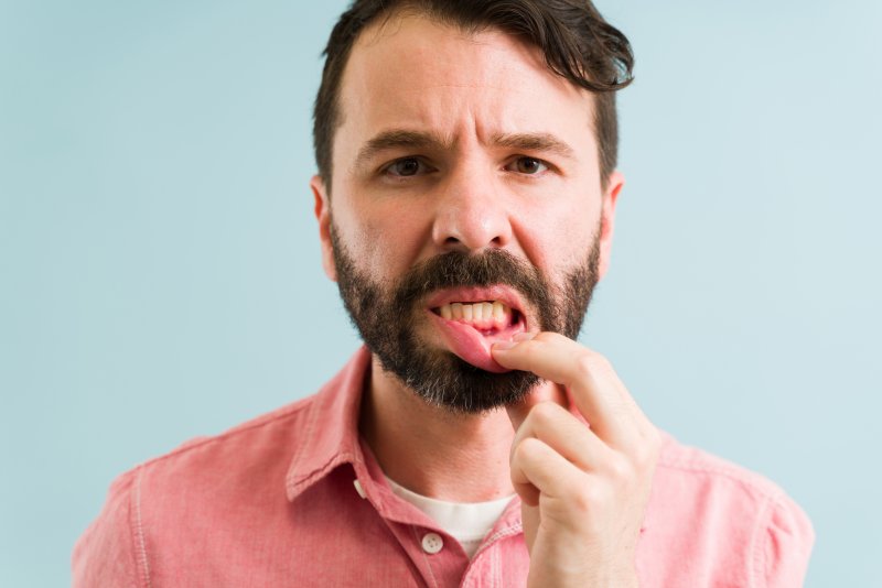 A young man suffering from gingivitis